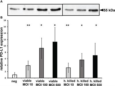 PD-L1 Up-Regulation in Prostate Cancer Cells by Porphyromonas gingivalis
